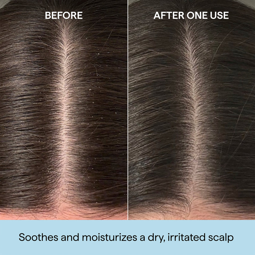 Scalp Revival Rosemary Pre Wash Oil
