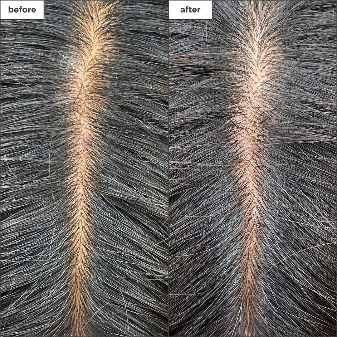 Scalp Revival Charcoal + Tea Tree Cooling Hydration Scalp Mask